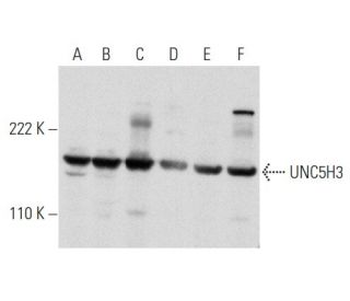 western blotting image from recommended UNC5H3 (F-4) monoclonal antibody replacement. Image 356976