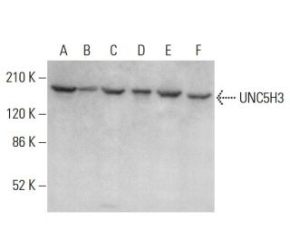 UNC5H3 Antibody (F-4) - Western Blotting - Image 377457