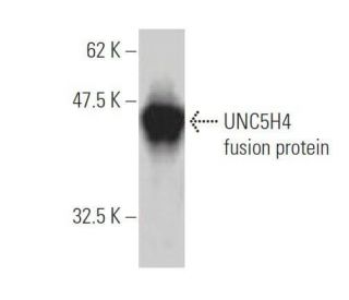 UNC5H4 Antibody (4G3) - Western Blotting - Image 350333