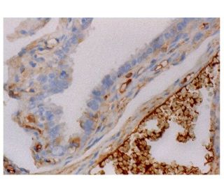 immunohistochemistry image from recommended uPAR (E-3) monoclonal antibody replacement. Image 287238