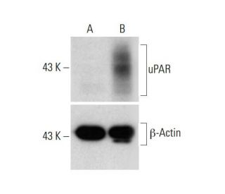 uPAR CRISPR Activation Plasmid (h): sc-400666-ACT. Western blot analysis of uPAR expression in non-transfected control (A)Each CRISPR/Cas9 Knockout (KO) Plasmid product consists of a pool of 3 plasmids designed to ensure identification and cleavage of a specific gene for maximum knockout efficiency. Each plasmid encodes a unique 20 nt sequence derived from the GeCKO (v2) library.