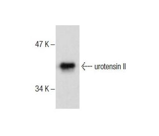 urotensin II Antibody (UII-6) - Western Blotting - Image 287667