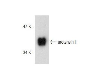urotensin II Antibody (UII-9) - Western Blotting - Image 287668