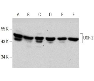 USF-2 Antibody (5E9) - Western Blotting - Image 368222Each CRISPR/Cas9 Knockout (KO) Plasmid product consists of a pool of 3 plasmids designed to ensure identification and cleavage of a specific gene for maximum knockout efficiency. Each plasmid encodes a unique 20 nt sequence derived from the GeCKO (v2) library.