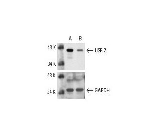 USF-2 siRNA (h): sc-36786. Western blot analysis of USF-2 expression in non-transfected control (A) and USF-2 siRNA transf 