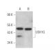USH1G Antibody (D-10) - Western Blotting - Image 371996