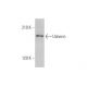 Usherin Antibody (G-6) - Western Blotting - Image 350844