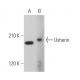 Usherin Antibody (G-6) - Western Blotting - Image 371351 