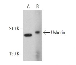 Usherin Antibody (G-6) - Western Blotting - Image 371351Each CRISPR/Cas9 Knockout (KO) Plasmid product consists of a pool of 3 plasmids designed to ensure identification and cleavage of a specific gene for maximum knockout efficiency. Each plasmid encodes a unique 20 nt sequence derived from the GeCKO (v2) library.