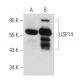USP14 Antibody (6E6) - Western Blotting - Image 55129