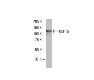 USP15 Antibody (2D5) - Western Blotting - Image 34000 