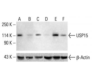 USP15 Antibody (2D5) - Western Blotting - Image 412738 