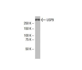 USP9 Antibody (5G-02) - Western Blotting - Image 33999 