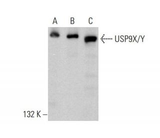 USP9X/Y Antibody (E-12) - Western Blotting - Image 381917 