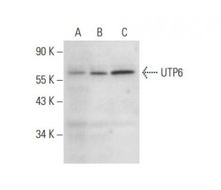 UTP6 Antibody (E-9) - Western Blotting - Image 309514 