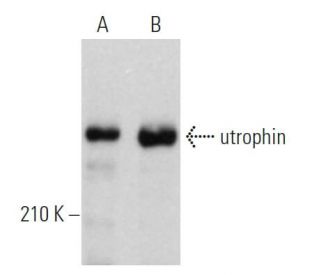 western blotting image from recommended utrophin (8A4) monoclonal antibody replacement. Image 361554