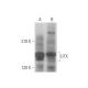 UTX Antibody (D-3) - Western Blotting - Image 352700