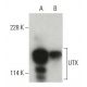 UTX Antibody (E-8) - Western Blotting - Image 396677