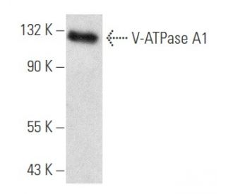 western blotting image from recommended V-ATPase A1 (E-8) monoclonal antibody replacement. Image 356631