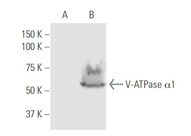 ルモントブーブレ1998 V-ATPase α1 Antibody (4F5) | SCBT - Santa Cruz Biotechnology