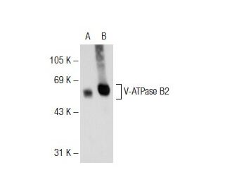 V-ATPase B2 Antibody (C-9) | SCBT - Santa Cruz Biotechnology V-ATPase B2 Antibody (C-9) | SCBT - Santa Cruz Biotechnology
