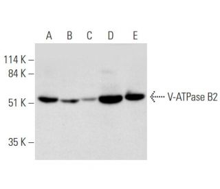 V-ATPase B2 Antibody (F-10) - Western Blotting - Image 333761 