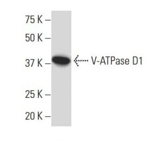 V-ATPase D1 Antibody (34-Z) - Western Blotting - Image 33537 