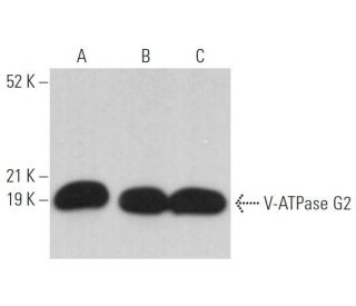 V-ATPase G2 Antibody (A-6) - Western Blotting - Image 371072 