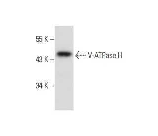 V-ATPase H Antibody (E-10): sc-271186