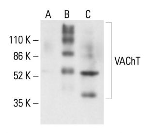 VAChT Antibody (H-10) - Western Blotting - Image 411254