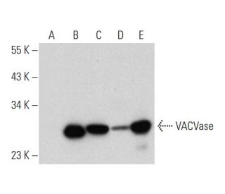 VACVase Antibody (E-3) - Western Blotting - Image 318346 