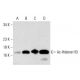 Valproic acid sodium salt: sc-202378. Western blot analysis of Histone H3 acetylation in untreated (A,C) and Valproic Acid