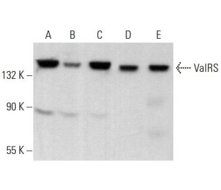 ValRS Antibody (D-7) - Western Blotting - Image 376319 