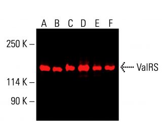 ValRS Antibody (D-7) - Western Blotting - Image 413154