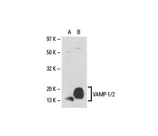VAMP-1/2 Antibody (4E240) - Western Blotting - Image 19275 