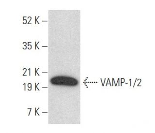 VAMP-1/2 Antibody (SP10) - Western Blotting - Image 355223 