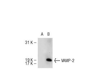 VAMP-1/2 Antibody (SP11) - Western Blotting - Image 55131 