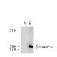 VAMP-1/2 Antibody (SP11) - Western Blotting - Image 55131 