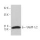 VAMP-1/2 Antibody (SP11) - Western Blotting - Image 361736