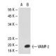 VAMP-2 Antibody (3E5) - Western Blotting - Image 30549