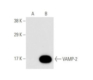 VAMP-2 Antibody (3E5) - Western Blotting - Image 58834 