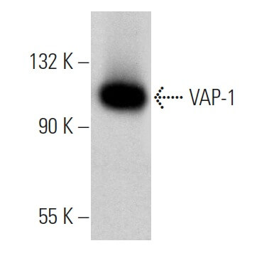 elfbar elfa kaufen Vascular adhesion protein-1 (VAP-1) in vascular inflammatory diseases: A  narrative review: Vasa: Vol 51, No 6 main image 1