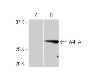 vap a VAP-A and its binding partner CERT drive biogenesis of RNA-containing  extracellular vesicles at ER membrane contact sites main image 1