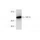 western blotting image from recommended VAP-A (4C12) monoclonal antibody replacement. Image 347600