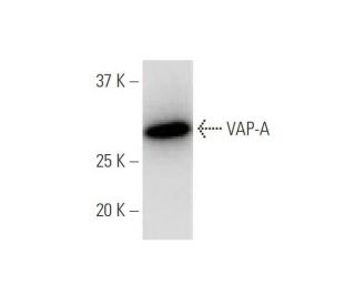 VAP-A Antibody (4C12) - Western Blotting - Image 347600