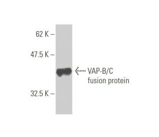 VAP-B/C Antibody (1A2) - Western Blotting - Image 348990