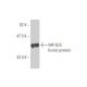 VAP-B/C Antibody (1A2) - Western Blotting - Image 348990
