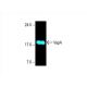 VapA Antibody (E-6) - Western Blotting - Image 394242
