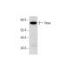western blotting image from recommended Vasa (C-2) monoclonal antibody replacement. Image 318364