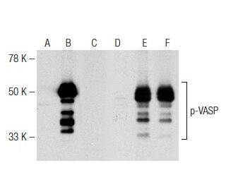 western blotting image from recommended VASP (A-11) monoclonal antibody replacement. Image 142640